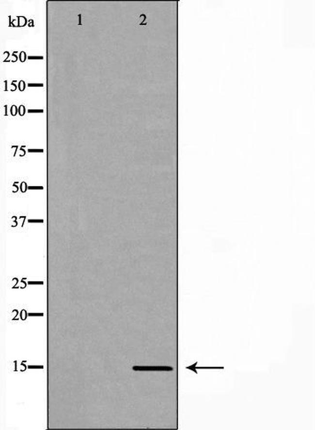 Luteinizing Hormone-beta Antibody in Western Blot (WB)