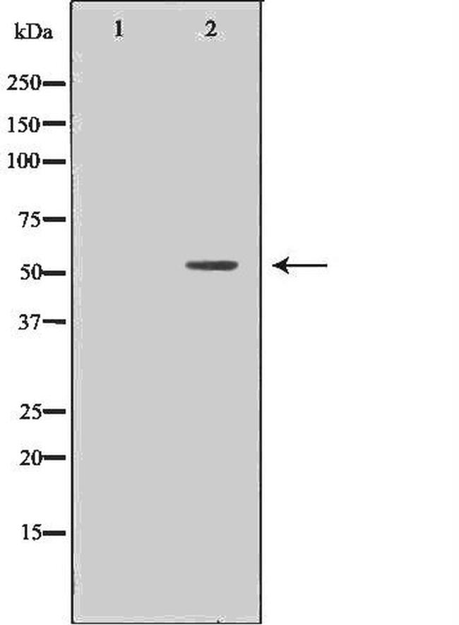 MMP11 Antibody in Western Blot (WB)