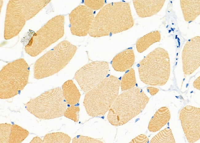 Orexin Receptor 2 Antibody in Immunohistochemistry (Paraffin) (IHC (P))