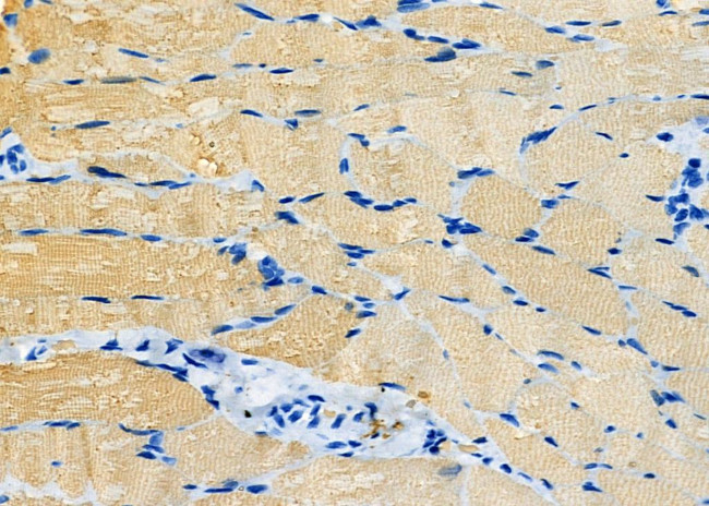 Orexin Receptor 2 Antibody in Immunohistochemistry (Paraffin) (IHC (P))