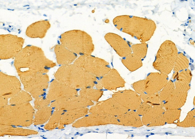 Orexin Receptor 2 Antibody in Immunohistochemistry (Paraffin) (IHC (P))