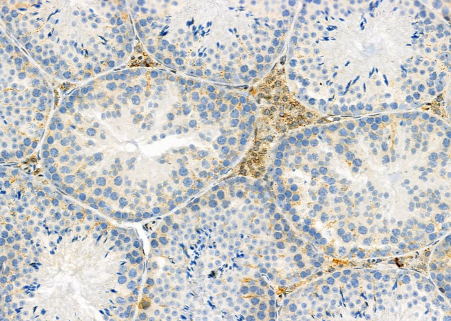 PIWIL2 Antibody in Immunohistochemistry (Paraffin) (IHC (P))