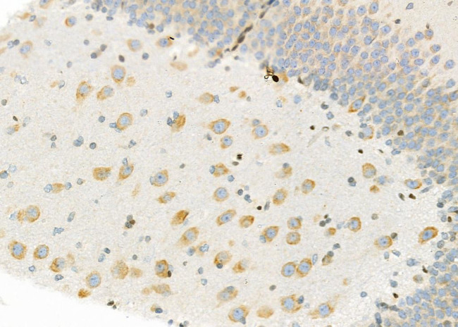 PIWIL2 Antibody in Immunohistochemistry (Paraffin) (IHC (P))