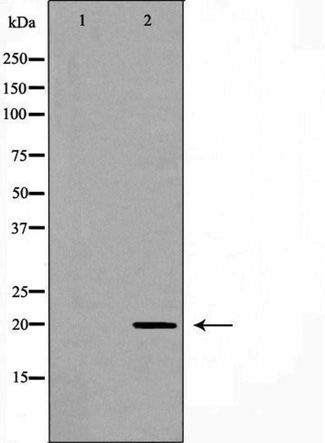 RAMP2 Antibody in Western Blot (WB)