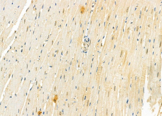 Rad52 Antibody in Immunohistochemistry (Paraffin) (IHC (P))