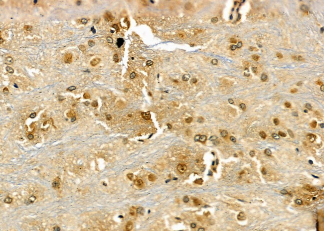 Rad52 Antibody in Immunohistochemistry (Paraffin) (IHC (P))