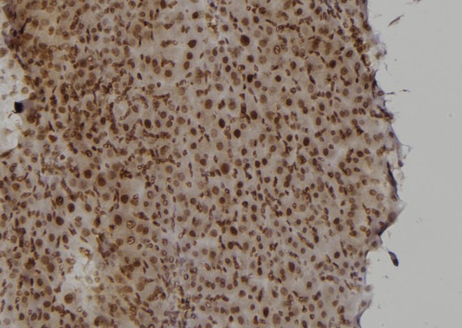 Rad52 Antibody in Immunohistochemistry (Paraffin) (IHC (P))