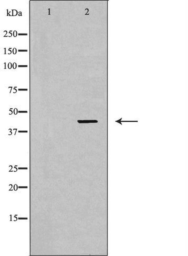 Nkx2.1 Antibody in Western Blot (WB)