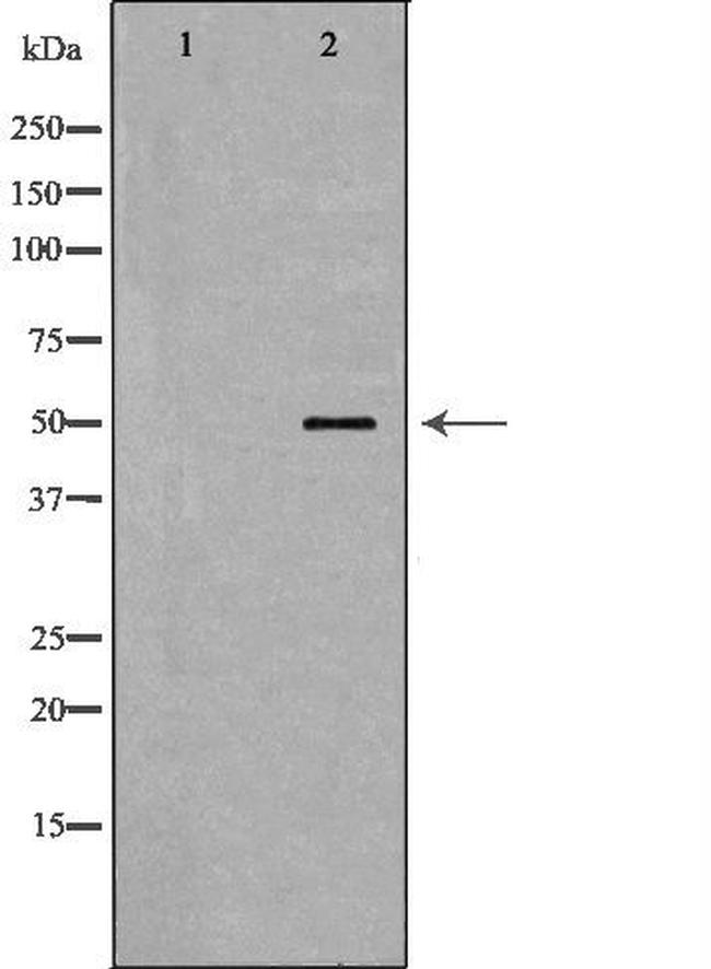 SCTR Antibody in Western Blot (WB)