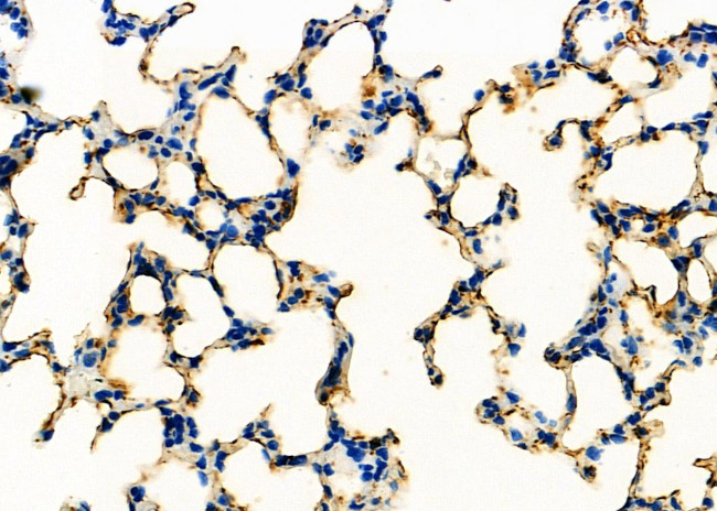 SFTPA1 Antibody in Immunohistochemistry (Paraffin) (IHC (P))