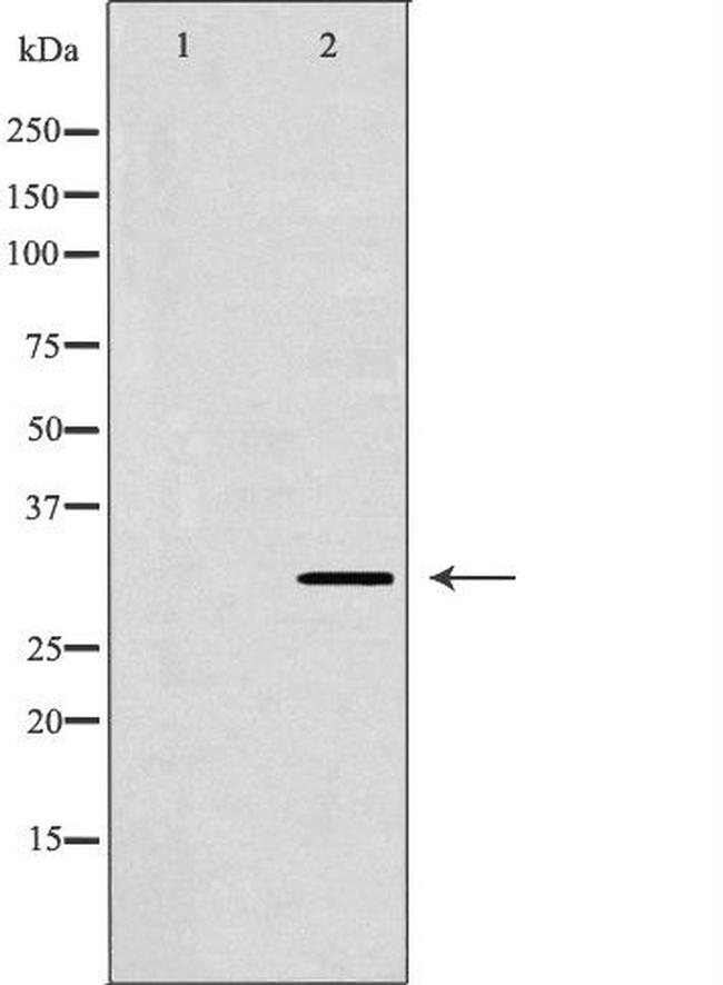 NTF3 Antibody in Western Blot (WB)