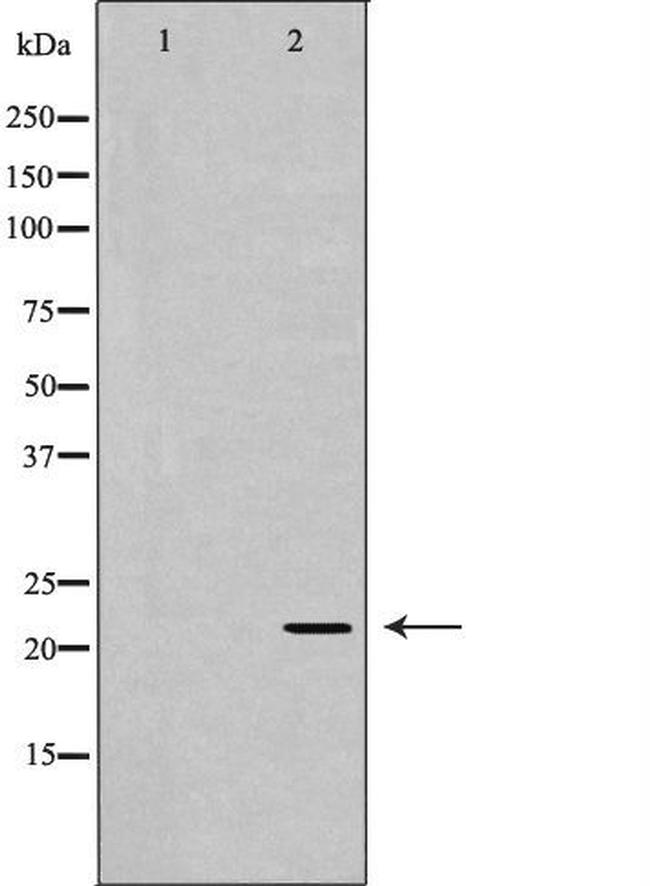 NTF4 Antibody in Western Blot (WB)