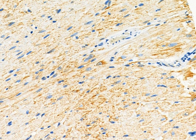 RRM2 Antibody in Immunohistochemistry (Paraffin) (IHC (P))