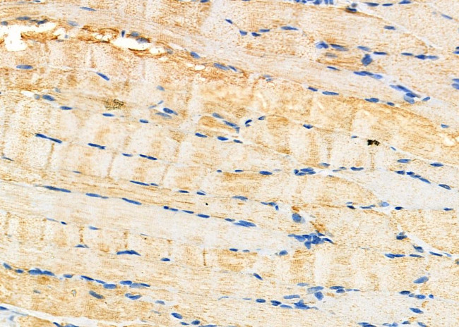 RRM2 Antibody in Immunohistochemistry (Paraffin) (IHC (P))