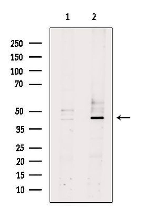 RRM2 Antibody in Western Blot (WB)