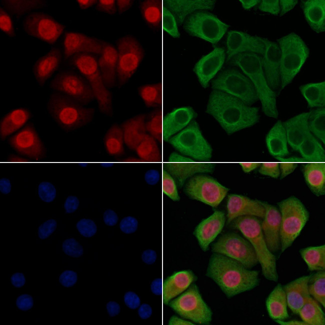 H3K14me1 Antibody in Immunocytochemistry (ICC/IF)