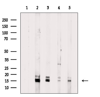 H3K14me2 Antibody in Western Blot (WB)