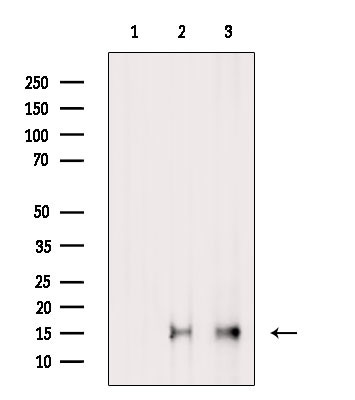 H3K14me2 Antibody in Western Blot (WB)