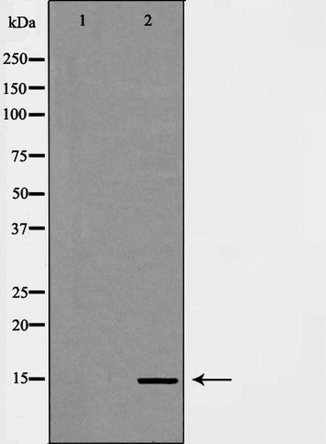 H3K14me3 Antibody in Western Blot (WB)