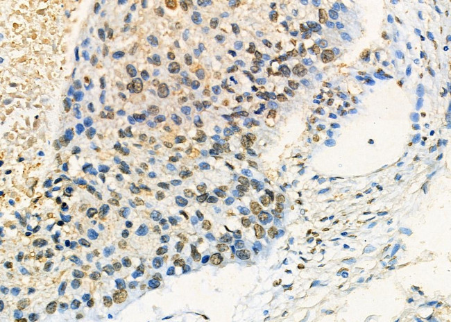 NONO Antibody in Immunohistochemistry (Paraffin) (IHC (P))