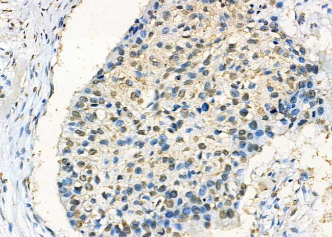 NONO Antibody in Immunohistochemistry (Paraffin) (IHC (P))