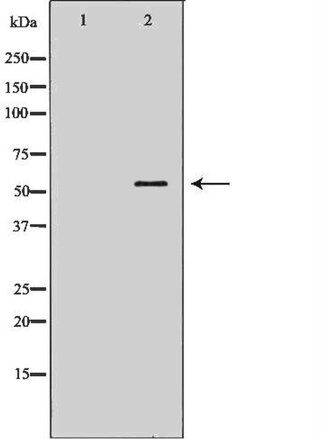 CHRNB1 Antibody in Western Blot (WB)