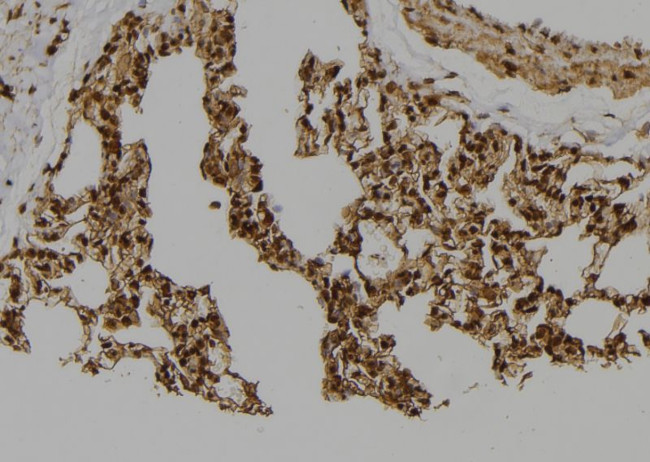 Geminin Antibody in Immunohistochemistry (Paraffin) (IHC (P))