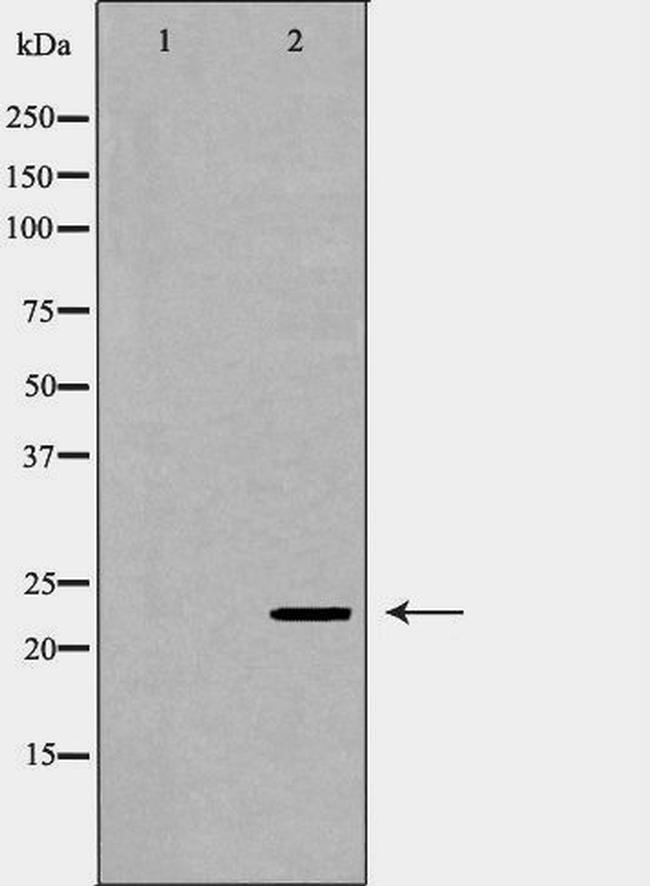 Geminin Antibody in Western Blot (WB)