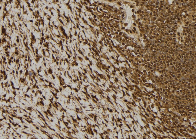 NDRG2 Antibody in Immunohistochemistry (Paraffin) (IHC (P))