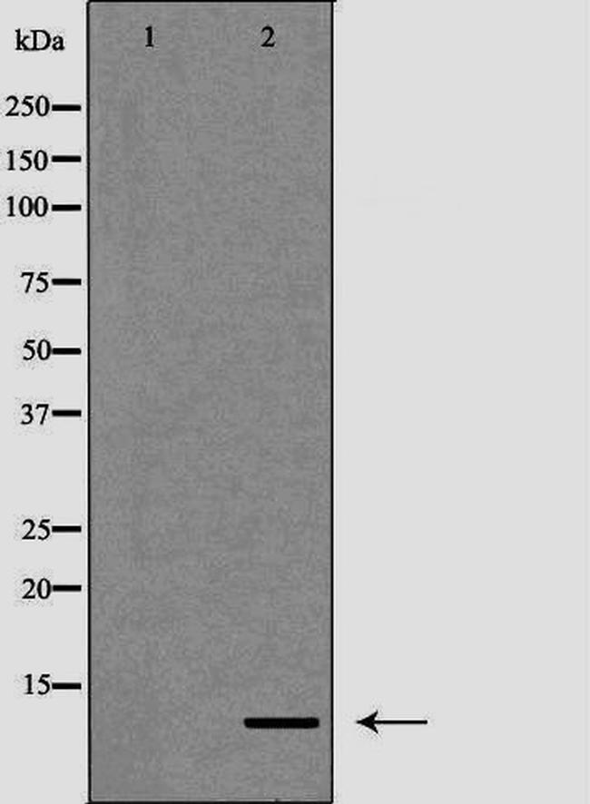 S100A12 Antibody in Western Blot (WB)