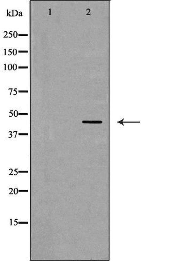 SERPINE2 Antibody in Western Blot (WB)