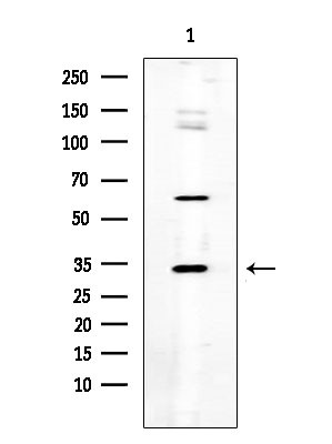 SGCE Antibody in Western Blot (WB)