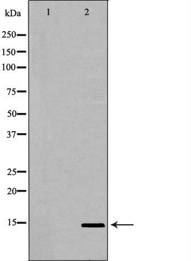 UTS2 Antibody in Western Blot (WB)