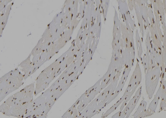 IMPDH2 Antibody in Immunohistochemistry (Paraffin) (IHC (P))