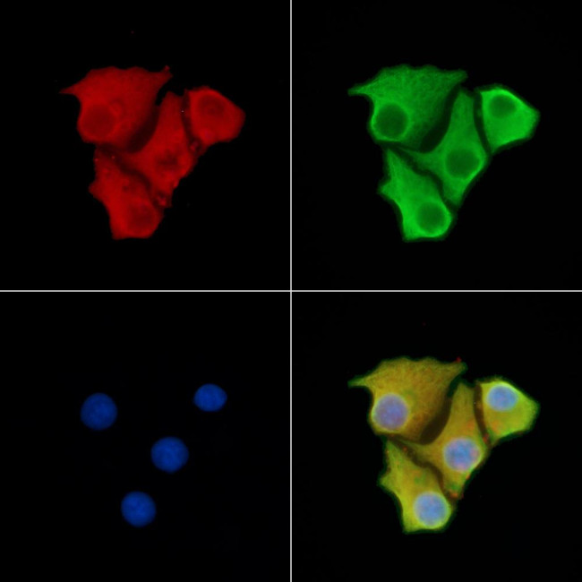 LTBR Antibody in Immunocytochemistry (ICC/IF)