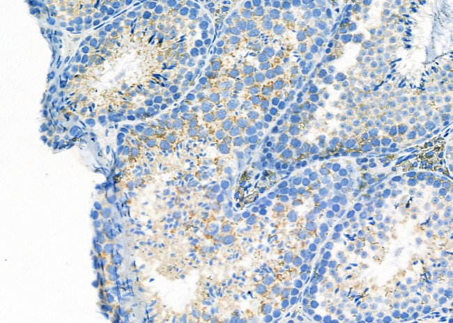 LTBR Antibody in Immunohistochemistry (Paraffin) (IHC (P))