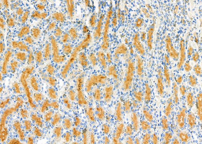 LTBR Antibody in Immunohistochemistry (Paraffin) (IHC (P))