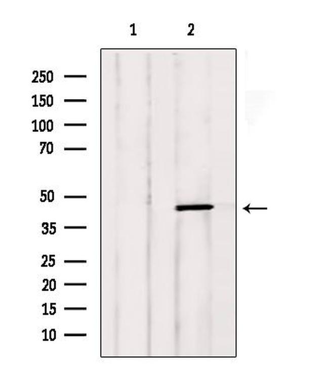 LTBR Antibody in Western Blot (WB)