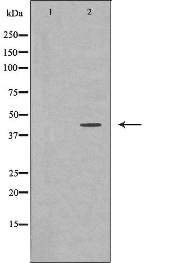 MVK Antibody in Western Blot (WB)