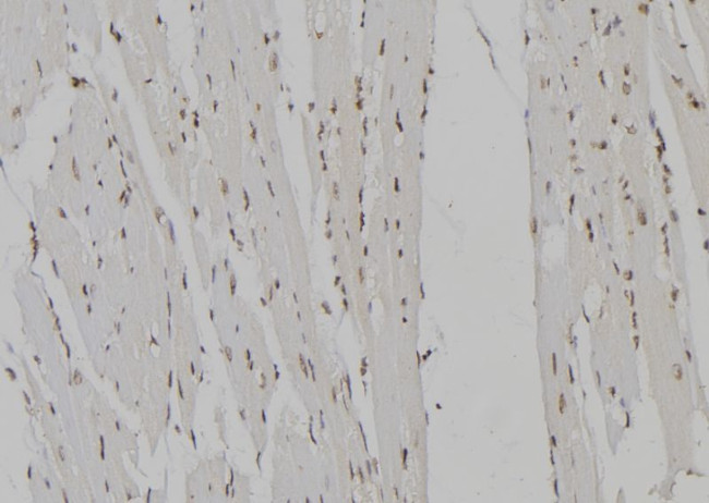 TCEB2 Antibody in Immunohistochemistry (Paraffin) (IHC (P))