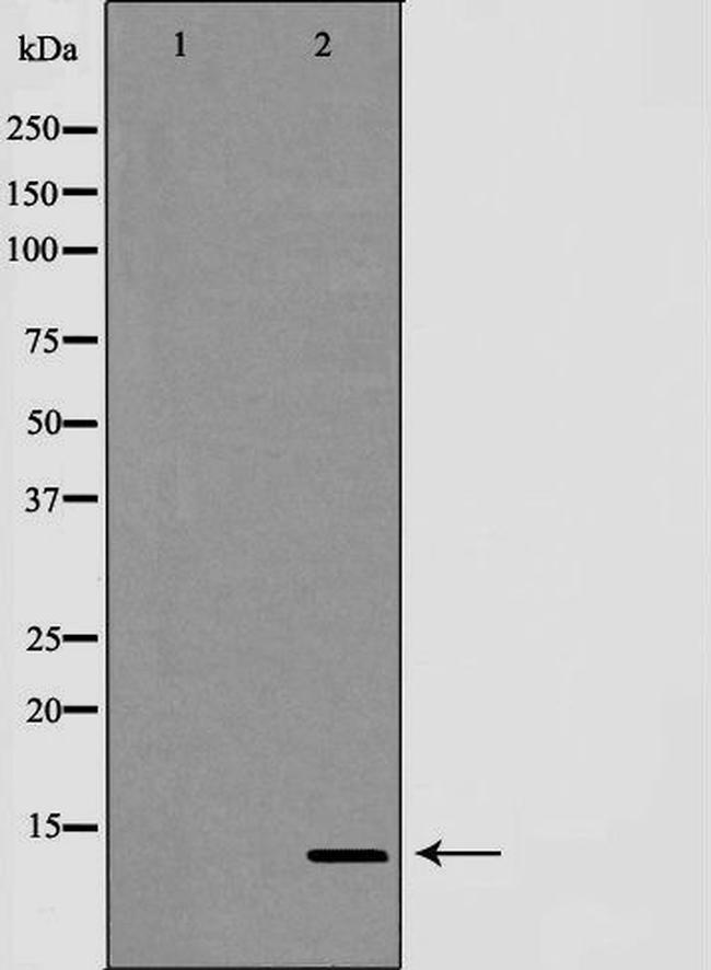 TCEB2 Antibody in Western Blot (WB)