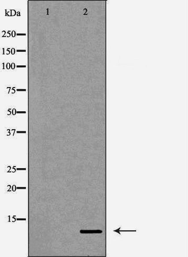 Diazepam Binding Inhibitor Antibody in Western Blot (WB)