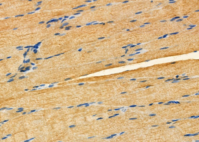 CD42a Antibody in Immunohistochemistry (Paraffin) (IHC (P))