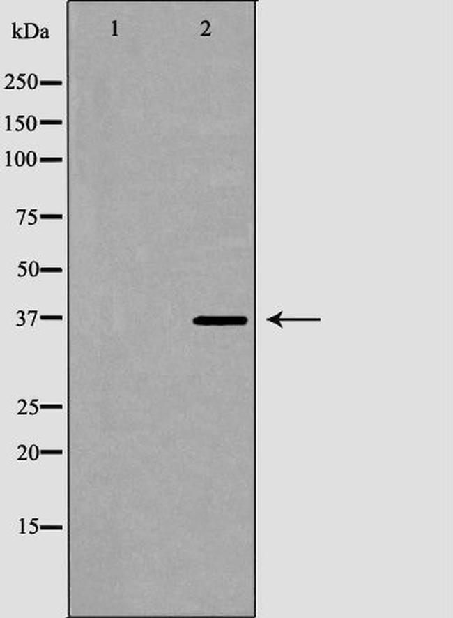 CD42a Antibody in Western Blot (WB)