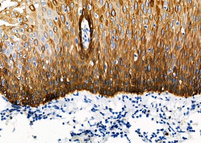 PSMC6 Antibody in Immunohistochemistry (Paraffin) (IHC (P))