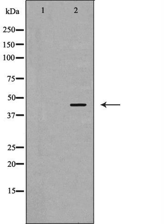 PSMC6 Antibody in Western Blot (WB)