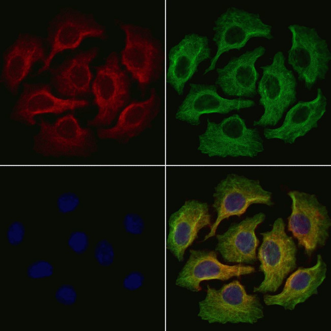 Properdin Antibody in Immunocytochemistry (ICC/IF)