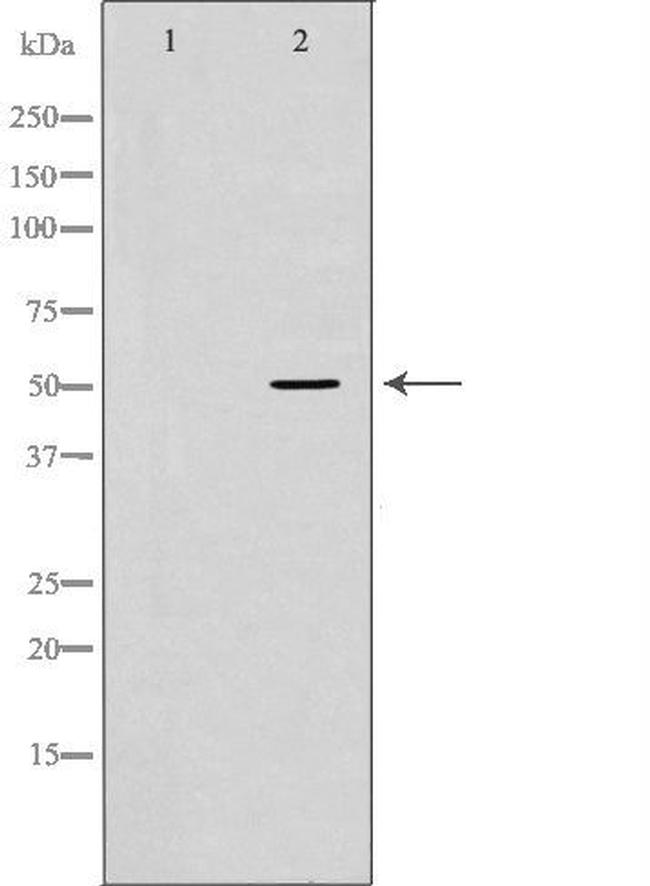 Properdin Antibody in Western Blot (WB)