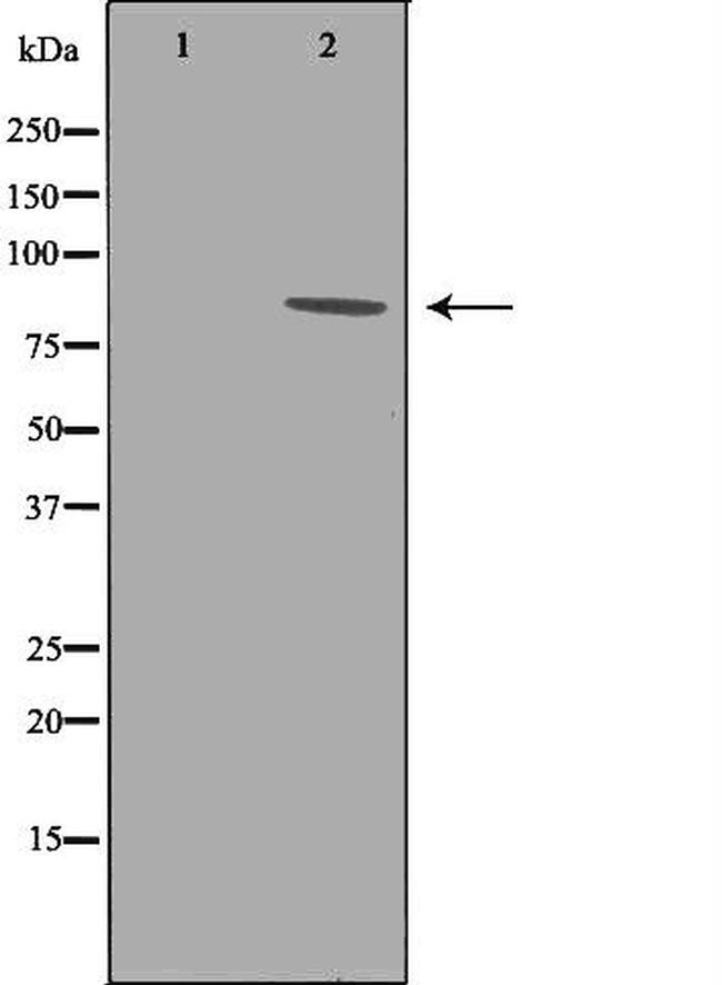 EEF2K Antibody in Western Blot (WB)