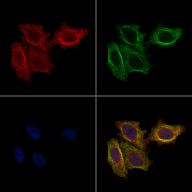 FBP1 Antibody in Immunocytochemistry (ICC/IF)